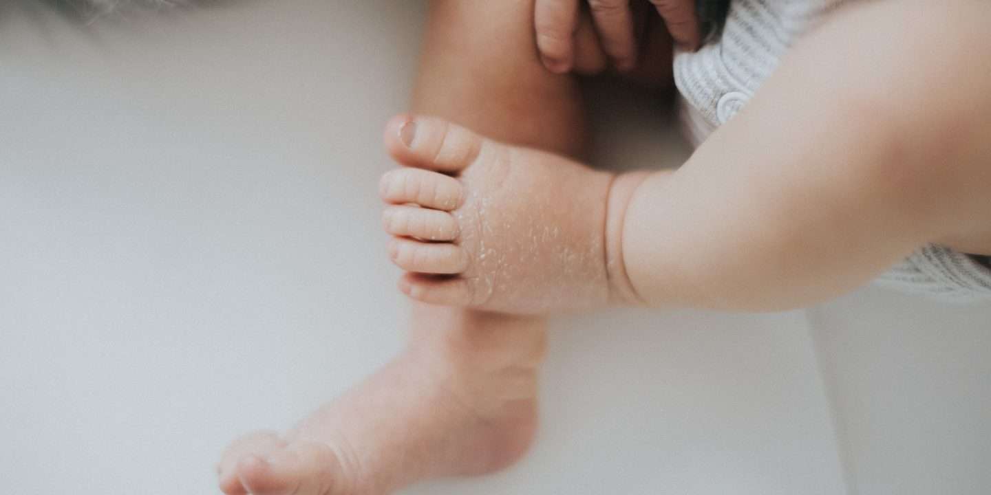 8 Rules to Care for Your Baby’s Skin… Protect It from Dryness and Irritation!