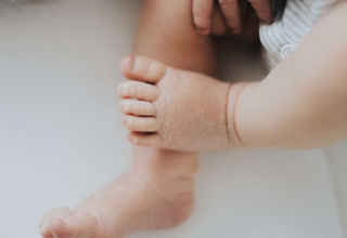 8 قواعد للعناية ببشرة طفلكِ الرضيع... احميها من الجفاف والحساسية!