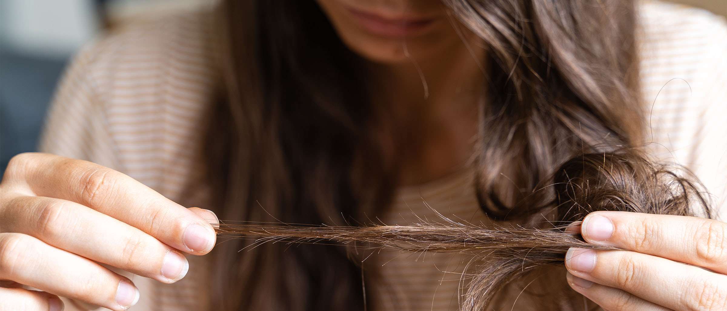 Time to Get Past Hair Loss... Face This Problem with Four Effective Steps!