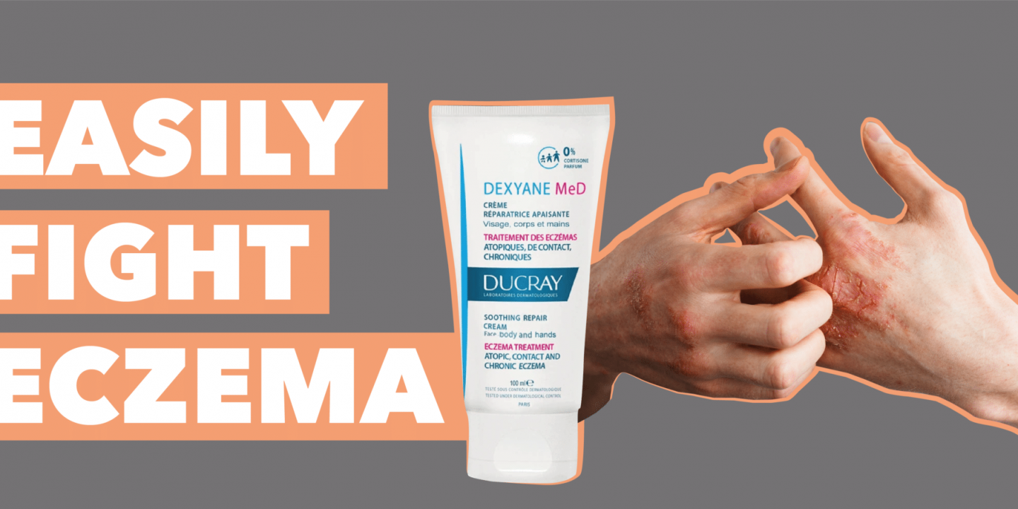 Eczema