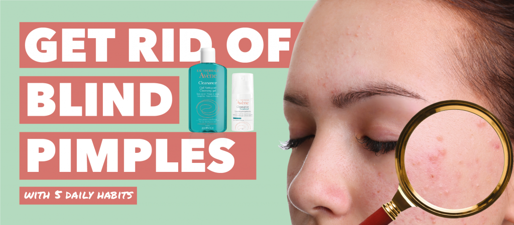 5 Simple Daily Habits to Get Rid of Blind Pimples | The Dermo Lab