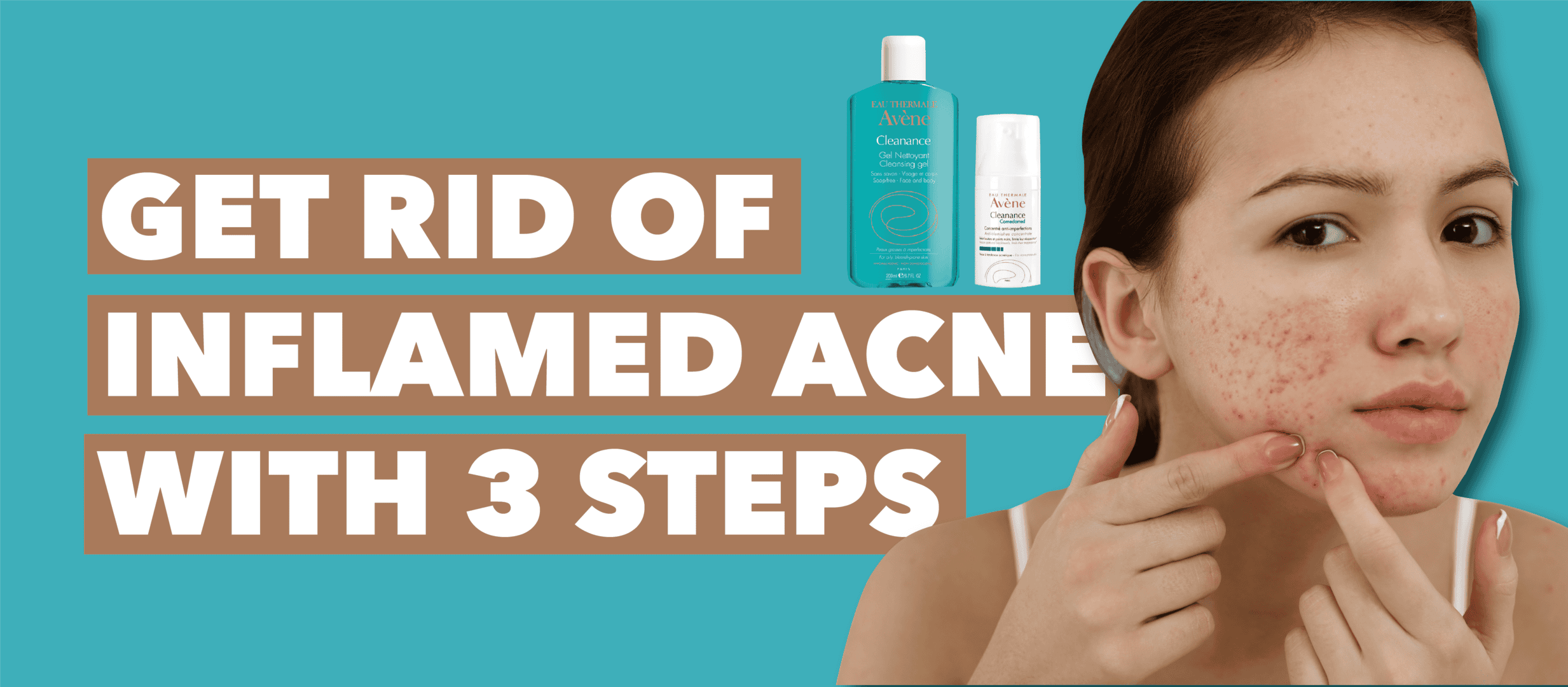 How To Get Rid Of Red Inflamed Acne