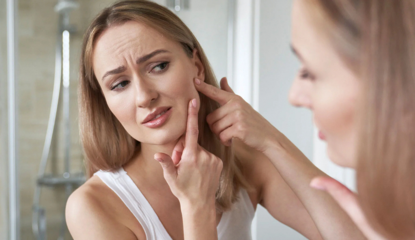 Different types of acne and how to treat them?