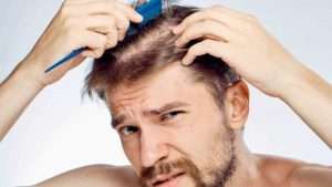 best hair loss treatment for men?