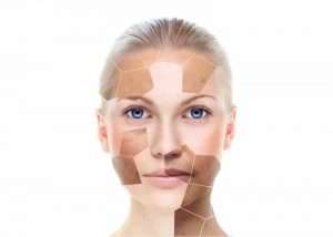 pigmentation treatment