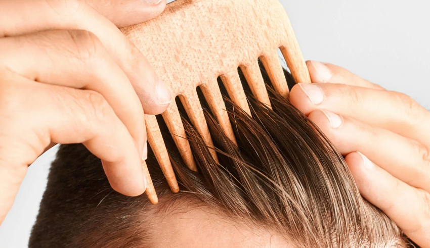 علاج قشرة الشعر: كيف ازيل القشرة من الشعر نهائيا؟