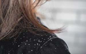 What is dandruff and how to get rid of it?