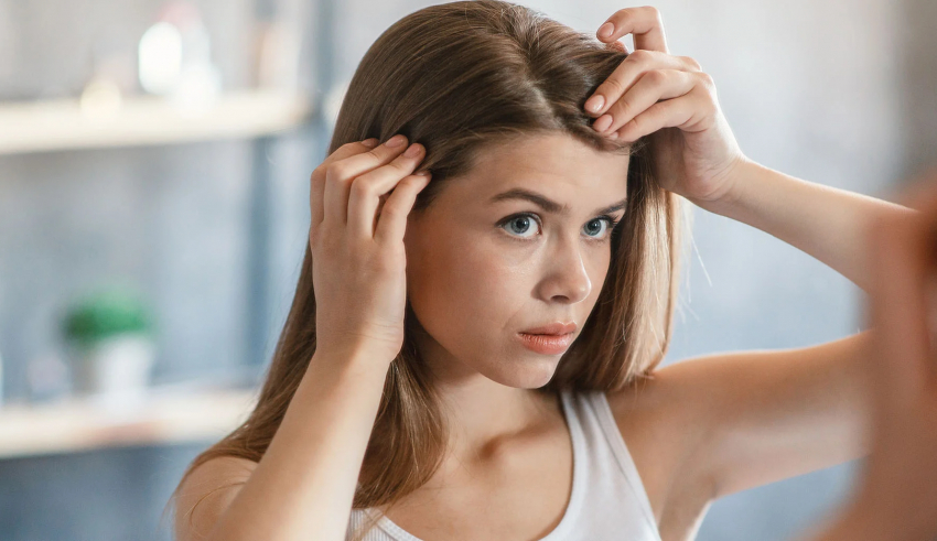 Types of hair dandruff and how to tackle each