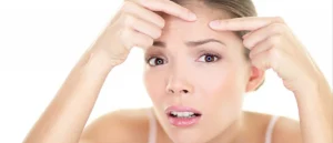 Forehead acne: Causes, treatment, and prevention