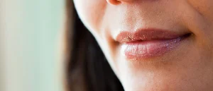 ما هو علاج التصبغ الداكن حول الفم؟