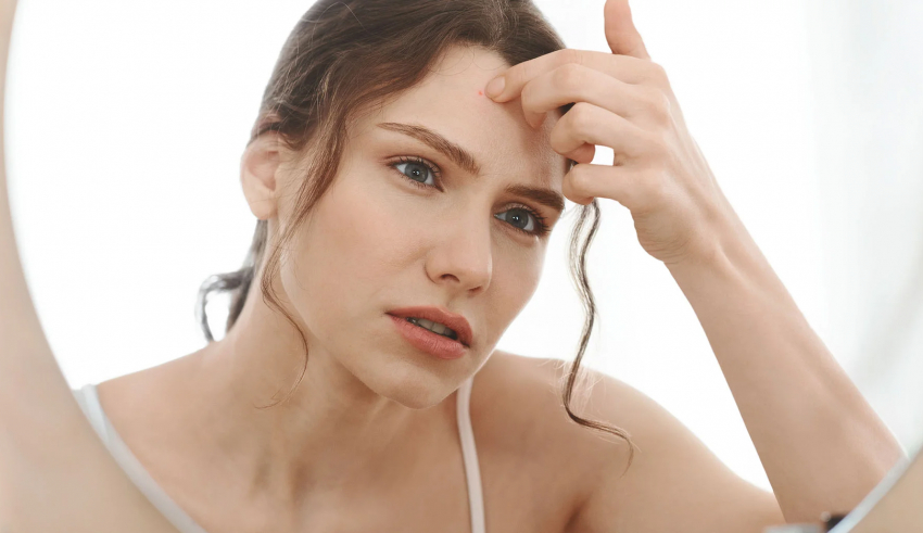 Forehead acne: Causes, treatment, and prevention