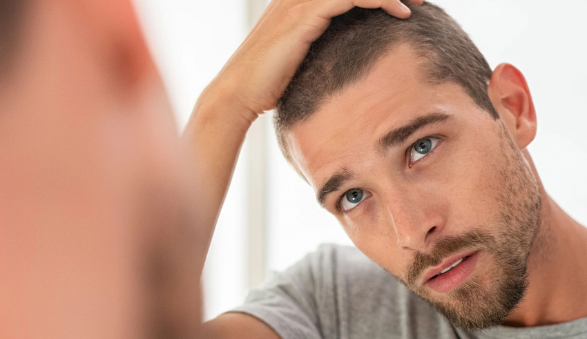 How do you get rid of seborrheic dermatitis on the scalp?