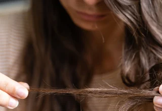 كيف يمكن علاج تساقط الشعر الشديد؟ حلول وخيارات العلاج