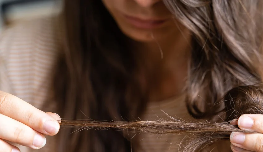كيف يمكن علاج تساقط الشعر الشديد؟ حلول وخيارات العلاج