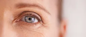 علاج تجاعيد العين: حل سحري للتخلص منها