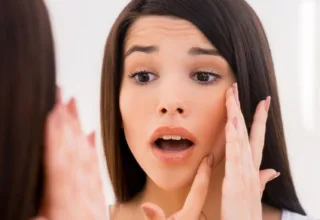 Acne-prone skin: What is it and what to do about it?