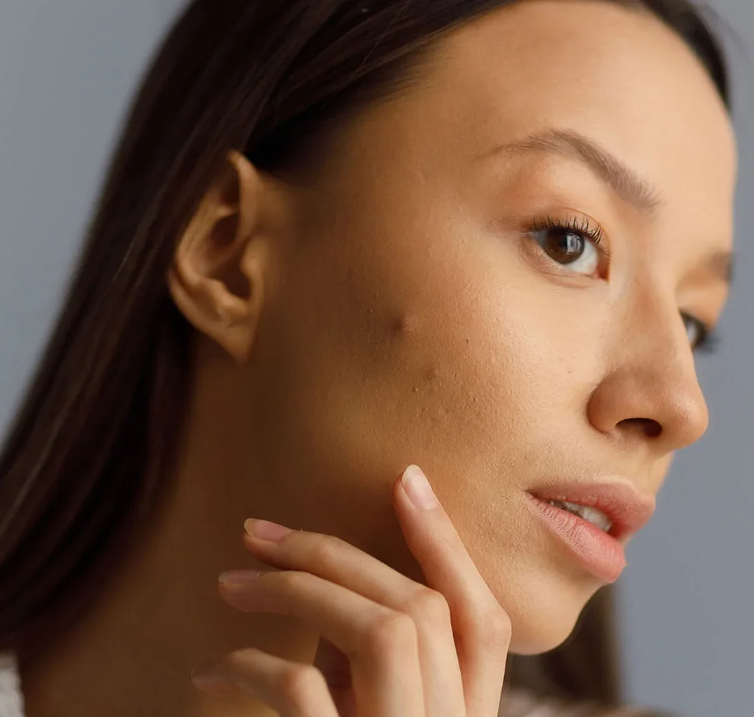Want Smoother, More Radiant Skin? Here are The Secrets to Banishing Textured Skin!