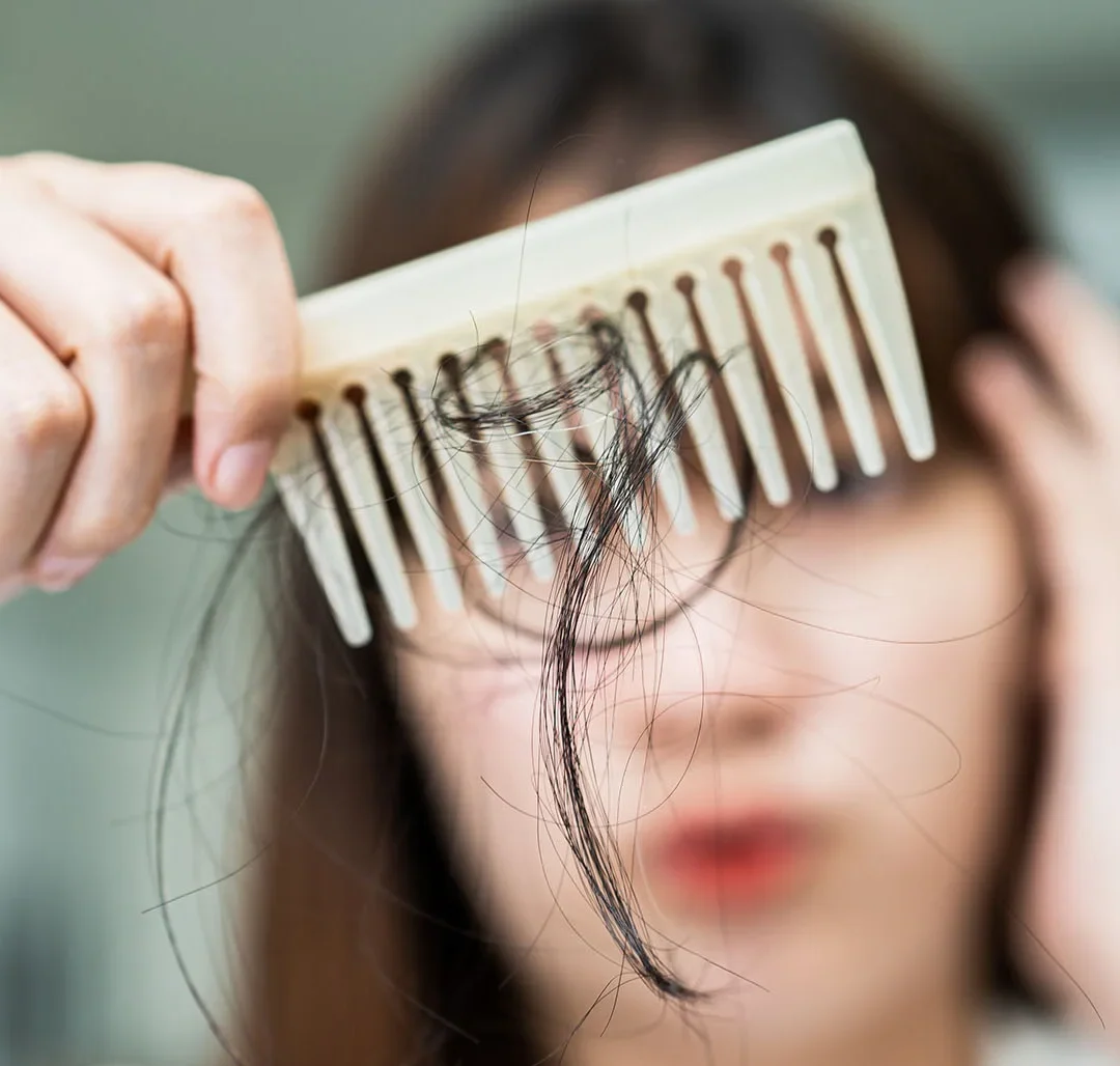 From Calm to Bald: The Surprising Impact of Stress on Your Hair