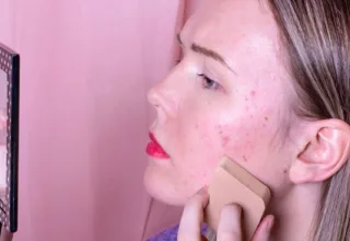 Covering Up, Not Covering Over: Makeup Hacks for Acne Sufferers
